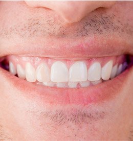 Closeup of healthy teeth and gums