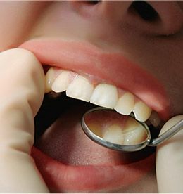 Closeup of smile druing dental exam